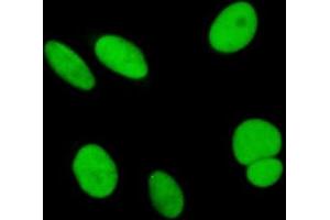 Immunofluorescence of purified MaxPab antibody to SAE1 on HeLa cell. (SAE1 anticorps  (AA 1-346))