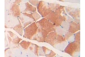 Detection of cTnI in Rat Skeletal muscle Tissue using Polyclonal Antibody to Cardiac Troponin I (cTnI)