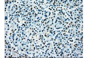 Immunohistochemical staining of paraffin-embedded liver tissue using anti-MAP2K4mouse monoclonal antibody.