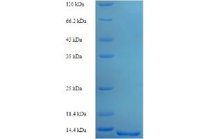 Histone H2B Type 2-E (HIST2H2BE) (AA 2-93) protein (His tag)