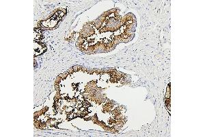 IHC analysis of RAB27A using anti-RAB27A antibody (ABIN7602714). (RAB27A anticorps  (AA 98-216))