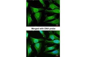 ICC/IF Image Immunofluorescence analysis of paraformaldehyde-fixed HeLa, using CAMK1D, antibody at 1:200 dilution. (CAMK1D anticorps)