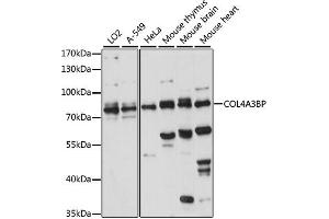 Western blot analysis of extracts of various cell lines, using COL4BP antibody (ABIN7266461) at 1:1000 dilution. (COL4A3BP anticorps  (AA 369-598))