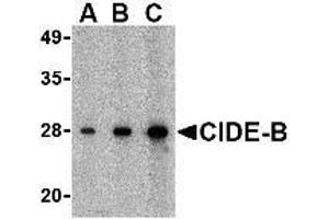 Western blot analysis of CIDE-B in mouse small intestine tissue lysate with AP30232PU-N CIDE-B antibody at (A) 0. (CIDEB anticorps  (C-Term))