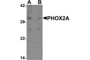 Western blot analysis of PHOX2A in rat brain tissue lysate with PHOX2A antibody at 1 ug/ml in (A) the absence and (B) the presence of blocking peptide. (PHOX2A anticorps  (C-Term))