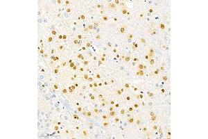 Immunohistochemistry of paraffin embedded rat brain using SOX1 (ABIN7075712) at dilution of 1:2000 (300x lens) (SOX1 anticorps)