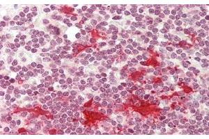 Detection of MDC in Human Small Intestine Tissue using Monoclonal Antibody to Macrophage Derived Chemokine (MDC)