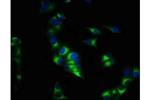 Immunofluorescence staining of Hela cells with ABIN7146107 at 1:200, counter-stained with DAPI.