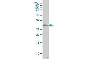 TP53RK monoclonal antibody (M02), clone 2A9 Western Blot analysis of TP53RK expression in COLO 320 HSR . (TP53RK anticorps  (AA 154-253))
