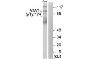 Western blot analysis of extracts from RAW264. (VAV1 anticorps  (pTyr174))