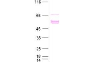 Validation with Western Blot