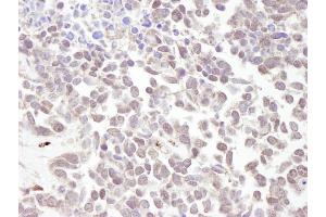 Immunohistochemistry (IHC) image for anti-Metastasis Associated 1 (MTA1) (AA 400-450) antibody (ABIN7448676) (MTA1 anticorps  (AA 400-450))