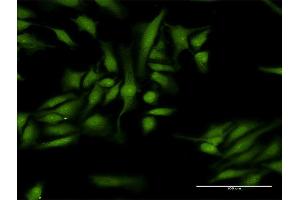 Immunofluorescence of purified MaxPab antibody to MTA1 on HeLa cell.