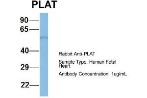 Host: Rabbit  Target Name: PLAT  Sample Tissue: Human Fetal Heart  Antibody Dilution: 1. (PLAT anticorps  (Middle Region))