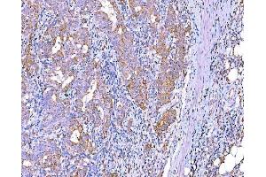 IHC analysis of RALBP1 using anti-RALBP1 antibody (ABIN7600800). (RALBP1 anticorps  (AA 239-506))