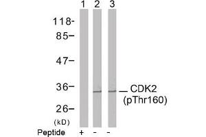 Image no. 2 for anti-Cyclin-Dependent Kinase 2 (CDK2) (pThr160) antibody (ABIN196844) (CDK2 anticorps  (pThr160))