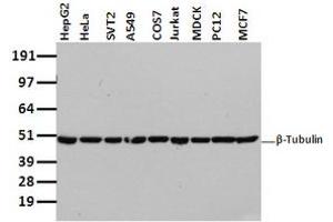 Image no. 2 for anti-Tubulin beta 4a (TUBB4A) antibody (ABIN1501580) (TUBB4 anticorps)