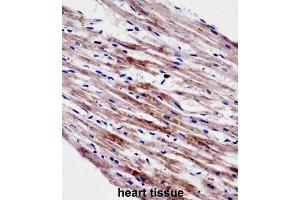 Immunohistochemistry (IHC) image for anti-Cardiotrophin 1 (CTF1) antibody (ABIN2998336) (Cardiotrophin 1 anticorps)