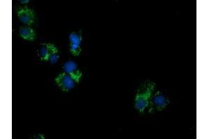 Anti-PECR mouse monoclonal antibody (ABIN2453444) immunofluorescent staining of COS7 cells transiently transfected by pCMV6-ENTRY PECR (RC200822). (PECR anticorps)