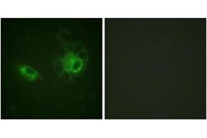 Immunofluorescence analysis of HeLa cells, using PDGFRB (Ab-1009) Antibody. (PDGFRB anticorps  (AA 981-1030))