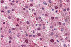 Human Liver: Formalin-Fixed, Paraffin-Embedded (FFPE) (RPS6KB1 anticorps  (AA 490-502))