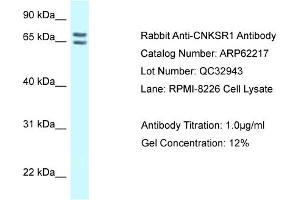 Western Blotting (WB) image for anti-Connector Enhancer of Kinase Suppressor of Ras 1 (CNKSR1) (C-Term) antibody (ABIN2789066) (CNKSR1 anticorps  (C-Term))