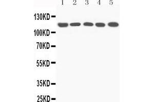 Anti-C5/C5a antibody, All Western blottingAll lanes: Anti-C5a at 0.
