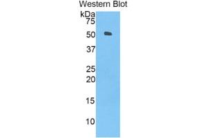 WB of Protein Standard: different control antibodies  against Highly purified E.
