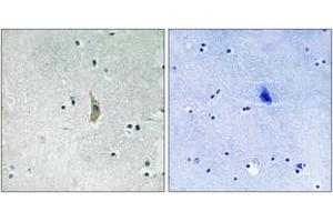 Immunohistochemistry analysis of paraffin-embedded human brain tissue, using PSEN1 (Ab-357) Antibody. (Presenilin 1 anticorps  (AA 323-372))