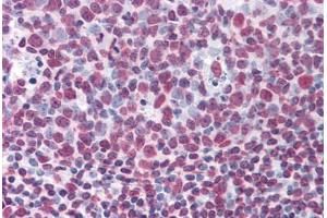 Human Tonsil: Formalin-Fixed, Paraffin-Embedded (FFPE)