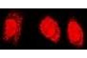 Immunofluorescent analysis of PSMC4 staining in U2OS cells. (PSMC4 anticorps)