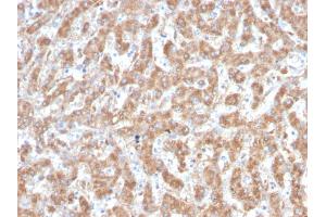 Formalin-fixed, paraffin-embedded human Liver stained with C1QA Mouse Monoclonal Antibody (C1QA/2952).