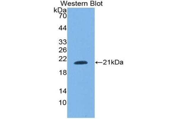 SNRPC anticorps  (AA 2-159)
