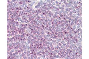 Anti-DLL1 antibody IHC of human spleen.