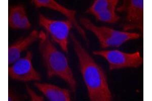 Immunofluorescence staining of methanol-fixed Hela cells using synapsin(Phospho-Ser9) Antibody.