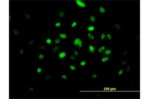 Immunofluorescence of purified MaxPab antibody to RNASEH2A on HeLa cell.