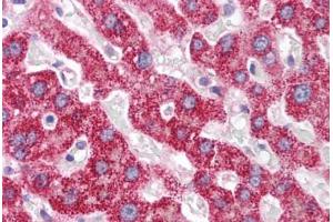 Human Liver (formalin-fixed, paraffin-embedded) stained with PCK1 antibody ABIN214134 at 5 ug/ml followed by biotinylated goat anti-rabbit IgG secondary antibody ABIN481713, alkaline phosphatase-streptavidin and chromogen.