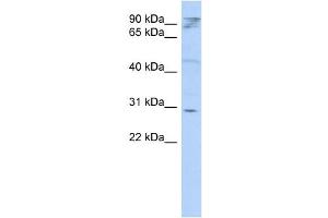 WB Suggested Anti-HAX1 Antibody Titration: 0. (HAX1 anticorps  (Middle Region))