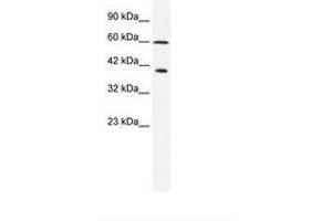Image no. 1 for anti-Minichromosome Maintenance Complex Component 7 (MCM7) (N-Term) antibody (ABIN203097) (MCM7 anticorps  (N-Term))