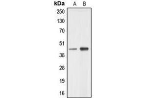 Western blot analysis of AARSD1 expression in A549 (A), HeLa (B) whole cell lysates. (AARSD1 anticorps  (Center))