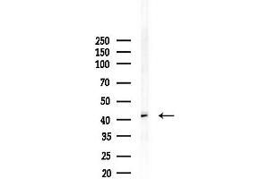 anti-Interleukin 10 Receptor, beta (IL10RB) (C-Term) antibody