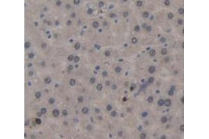 IHC-P analysis of Rat Tissue, with DAB staining. (CD11b anticorps  (AA 31-160))