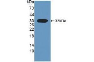 Detection of Recombinant DKK1, Human using Monoclonal Antibody to Dickkopf Related Protein 1 (DKK1) (DKK1 anticorps  (AA 33-266))