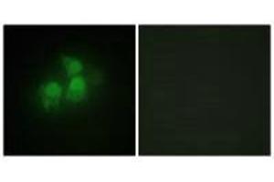Immunofluorescence analysis of HepG2 cells, using IPPK antibody. (IPPK anticorps)
