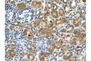 Immunohistochemistry (IHC) image for anti-Cystatin B (Stefin B) (CSTB) (Middle Region) antibody (ABIN2782349)