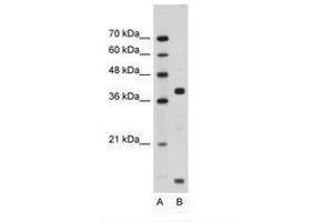 Image no. 1 for anti-FXYD Domain Containing Ion Transport Regulator 5 (FXYD5) (AA 66-115) antibody (ABIN203357) (FXYD5 anticorps  (AA 66-115))