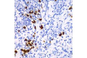Immunohistochemistry of paraffin-embedded mouse spleen using TFAM antibody.