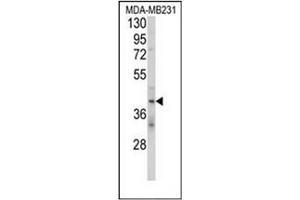 Western blot analysis of CD158d / KIR2DL4 Antibody (C-term) in MDA-MB231 cell line lysates (35ug/lane).