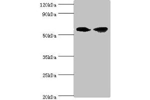 Western blot All lanes: AHCYL1 antibody at 12 μg/mL Lane 1: Hela whole cell lysate Lane 2: 293T whole cell lysate Secondary Goat polyclonal to rabbit IgG at 1/10000 dilution Predicted band size: 59, 54 kDa Observed band size: 59 kDa (AHCYL1 anticorps  (AA 31-260))