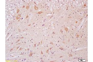 Paraformaldehyde-fixed, paraffin embedded Rat Spinal Cord Antigen retrieval by boiling in sodium citrate buffer (pH6.